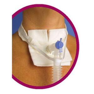 TRACH TUBE HOLD VENT ANTI DIS CONNECT 20